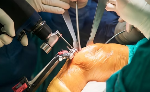 Knee and hip joint replacement surgery in Manikonda